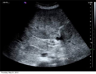 Thursday, May 31, 2012
 