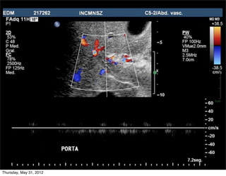 Thursday, May 31, 2012
 