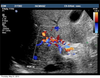 Thursday, May 31, 2012
 