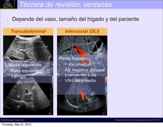 Técnica de revisión: ventanas

     • Depende del vaso, tamaño del hígado y del paciente

         Transabdominal          Intercostal (DLI)




                             Porta hepatis
   Lóbulo izquierdo          •   Porta principal
   •     Porta izquierda     •   Art. Hepática principal
   •     VSH izq                 y ramas der e izq
                             •   VSH der y media




incich/grupo ct scanner                                    Departamento de Radiología/Unidad PET-CT

Thursday, May 31, 2012
 