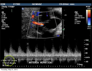 Thursday, May 31, 2012
 