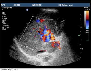 Thursday, May 31, 2012
 