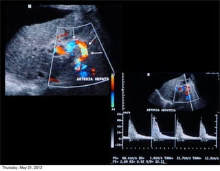 Thursday, May 31, 2012
 