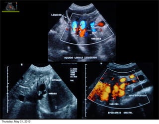 Thursday, May 31, 2012
 