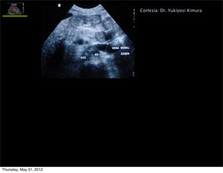 Cortesía: Dr. Yukiyosi Kimura




Thursday, May 31, 2012
 