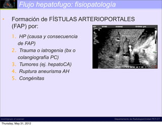 Flujo hepatofugo: fisiopatología

 •        Formación de FÍSTULAS ARTERIOPORTALES
          (FAP) por:
          1. HP (causa y consecuencia
             de FAP)
          2. Trauma o iatrogenia (bx o
             colangiografía PC)
          3. Tumores (ej. hepatoCA)
          4. Ruptura aneurisma AH
          5. Congénitas




incich/grupo ct scanner                         Departamento de Radiología/Unidad PET-CT

Thursday, May 31, 2012
 
