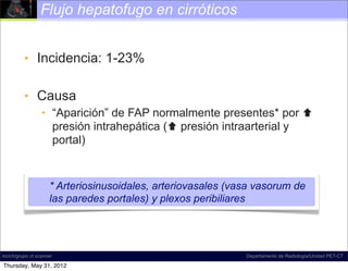 Flujo hepatofugo en cirróticos


          • Incidencia: 1-23%

          • Causa
                  • “Aparición” de FAP normalmente presentes* por 
                    presión intrahepática ( presión intraarterial y
                    portal)


                     * Arteriosinusoidales, arteriovasales (vasa vasorum de
                     las paredes portales) y plexos peribiliares




incich/grupo ct scanner                                       Departamento de Radiología/Unidad PET-CT

Thursday, May 31, 2012
 