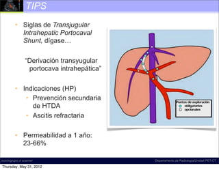 TIPS
          • Siglas de Transjugular
            Intrahepatic Portocaval
            Shunt, dígase…


                 “Derivación transyugular
                  portocava intrahepática”


          • Indicaciones (HP)
             • Prevención secundaria
               de HTDA
             • Ascitis refractaria

          • Permeabilidad a 1 año:
            23-66%

incich/grupo ct scanner                      Departamento de Radiología/Unidad PET-CT

Thursday, May 31, 2012
 