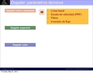 Doppler: parámetros técnicos
         Doppler color y espectral       •   Línea basal
                                        •   Escala de velocidad (PRF)
                                         •   Filtros
                                         •   Inversión de flujo

                 Doppler espectral




                    Doppler color




incich/grupo ct scanner                                  Departamento de Radiología/Unidad PET-CT

Thursday, May 31, 2012
 