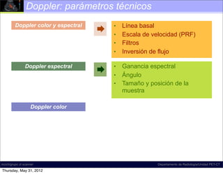 Doppler: parámetros técnicos
         Doppler color y espectral       •   Línea basal
                                        •   Escala de velocidad (PRF)
                                         •   Filtros
                                         •   Inversión de flujo

                 Doppler espectral       •   Ganancia espectral
                                        •   Ángulo
                                         •   Tamaño y posición de la
                                             muestra

                    Doppler color




incich/grupo ct scanner                                  Departamento de Radiología/Unidad PET-CT

Thursday, May 31, 2012
 