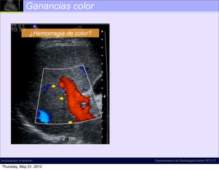 Ganancias color

                    ¿Hemorragia de color?




                           

                               



                                   




incich/grupo ct scanner                     Departamento de Radiología/Unidad PET-CT

Thursday, May 31, 2012
 