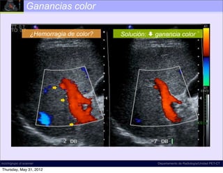 Ganancias color

                    ¿Hemorragia de color?   Solución:  ganancia color




                           

                               



                                   




incich/grupo ct scanner                                 Departamento de Radiología/Unidad PET-CT

Thursday, May 31, 2012
 