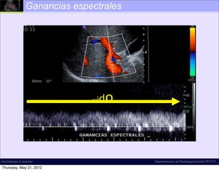 Ganancias espectrales




                                id
                               ru    o



incich/grupo ct scanner                  Departamento de Radiología/Unidad PET-CT

Thursday, May 31, 2012
 