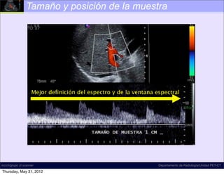 Tamaño y posición de la muestra




                     Mejor definición del espectro y de la ventana espectral




incich/grupo ct scanner                                             Departamento de Radiología/Unidad PET-CT

Thursday, May 31, 2012
 