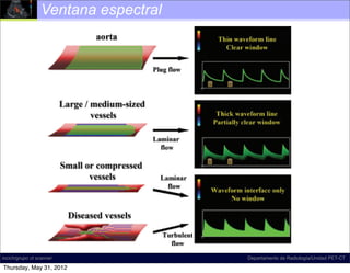 Ventana espectral

                                                                                         Caus
                                                                                         Artiﬁ
                                                                                           Lar
                                                                                           Hig
                                                                                         Physi
                                                                                           No
                                                                                           No
                                                                                         Patho
                                                                                           Co
                                                                                           Tur



                                                                                       vessel e
                                                                                       aorta. T
                     Figure 10. Diagrams illustrate “spectral window” andRadiología/Unidad PET-CT
incich/grupo ct scanner                                           Departamento de
                                                                                       tral wa
            spectral broadening. In the proximal aorta (top left),
 Thursday, May 31, 2012
 