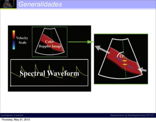 color Doppler examination includes gray-scale US (B-
           Generalidades
       mode imaging).




     Figure 2. Spectral Doppler examination components.
     Diagram at left shows the general layout of a spectral
     Doppler image. The spectral waveform is displayed
incich/grupo ct scanner                      Departamento de Radiología/Unidad PET-CT

     on the lower half of the image, a color Doppler image
Thursday, May 31, 2012
 