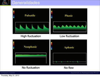 Generalidades

                                                              trate th
                                                              used to
                                                              undula
                                                              velocity
                                                              wavefo
                                                              and no
                                                              phasic
                                                              phasic
                                                              teries b
                                                              veins. N
                                                              a phas
                                                              no velo
                                                              though
                                                              The te
                                                              out ph
                                                              is no ﬂ
incich/grupo ct scanner          Departamento de Radiología/Unidad PET-CT

Thursday, May 31, 2012
 