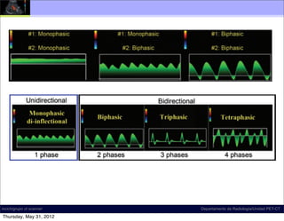 radiographics.rsna.org

    Figure 6. Phase interpretation ambiguity. Schematics illustrate how different
    interpretations of what constitutes a phase can affect waveform characteriza-
    tion and nomenclature. D.A.M. interprets a phase as a component of the
    waveform on either side of the baseline; M.M.A.Y. interprets a phase as an
    inﬂection.

    Figure 6. Phase interpretation ambiguity. Schematics illustrate how different
    interpretations of what constitutes a phase can affect waveform characteriza-
    tion and nomenclature. D.A.M. interprets a phase as a component of the
    waveform on either side of the baseline; M.M.A.Y. interprets a phase as an
    inﬂection.




    Figure 7. Directionality and phase quantiﬁcation. When phase is deﬁned as
    a component of phasic ﬂow direction, waveforms may be described in terms
    of the number of phases. All monophasic waveforms are unidirectional; bidi-
    rectional waveforms may be either biphasic, triphasic, or tetraphasic.
incich/grupo ct scanner                                     Departamento de Radiología/Unidad PET-CT

Thursday, May 31, 2012
 