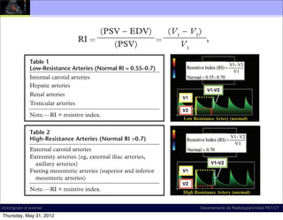the PI in the portal vein (V2/V1). The most fre-                                           theless u
                           quently used index in the hepatic arteries is the                                          the RI o
                           RI, which is calculated as
                                                                                                                         1. A h
                                        (PSV − EDV)        (V1 − V2)                                                  therefor
                                 RI =                   =             ,
                                            (PSV)              V1                                                     ing than

               Table 1        where PSV = peak systolic velocitycorrelates with, the number of sounds
                                                                                      and EDV =                                2. An
                                                                                    audio Doppler US. With this interpretthe post
                              end diastolic velocity. Calculating the RI is phases (phase quantiﬁcatio
                                                                                    number of prob-
                              ably the easiest part of measuring and reporting inﬂection diffuse d
                   Internal carotid arteries
                                                                                    to the number of                      points con
                   Hepatic arteries
                              arterial impedance; most US vendors provide one cycle.wide var
                   Renal arteries
                                                                                    waveform during
                                                                                       Perhaps in the future, a consensusease due
                              software that automatically performs this calcula-
                   Testicular arteries                                              addressing what constitutes a phase an
                              tion. What to radiographics.rsna.org is much less clear. will be3. An
                                                    do with the result ate phase quantiﬁcation                                 forthc
                   Note.—RI = resistive index.
                              This is because the normal range varies from oneto overall waveform
                                                                                    cially as it pertains                proxima
 n-                                      institution, and publishedarteries. Schematics illustrate thatarticle, D.A.
                                                     High- versus low-resistance
                                                                                   article to the in this a(arteriov
                                                                                    ture. Nonetheless,
                   Table 2 artery, high-resistance artery (left) allows less blood ﬂow during end diastole (the
nce;                                                                                pretation of phase will be used for pha
e                             next. Furthermore,such that the
                                         trough is lower) than does signiﬁcance of (right). These visual ﬁndings severe
               ization of any wave can be achieved            the a low-resistance artery an abnor-
                                                                                    cation and subsequent waveform nom   in
                                         are conﬁrmed by calculating an RI. High-resistance arteries normally have RIs
               words usedmal result 0.7,not could be entered Therefore, it is wise to 0.7.
                   External carotid arteries is wave always clear.
                               to describe the whereas low-resistance arteries have RIs ranging from 0.55
                                         over                                                                            injury);
                   Extremity arteries (eg, external iliac is a low-resistance artery.
                                                             arteries,
               into a computer to relyhepatic artery these measurements; rather,
-                             not andThe waveform recreated.
                                          the solely on
                      axillary arteries)good to know that phase
                                                                                    Unidirectional versus Bidirectional.—
                              they should such as and supporting unidirectionaldirection of ﬂow can also
                    Regardless, it is
                   Fasting mesenteric arteries be used asinferior
               quantiﬁcation descriptors          (superior
                                                                       ,
                                                                                     data. the and
                                                                                    describe                             Flow 7)
                                                                                                                              (Fig P
                      mesenteric arteries)
ter-                      , and In general, ambiguous given arteries normally direction (whetherar
                                            can be low-resistance                   ﬂow in only one                      There a
                   Note.—RI = in the RI of 0.55–0.7. The hepatic retrograde) can be said to have un
                              have an index.
               this differenceresistivedeﬁnition of phase. Another                  or artery is Causes of Spectral Bro  ﬂow (no
e-             point to keeplow-resistance vessel; however, wider normalonly be monophasic
                              a in mind is that nonphasic waves do                  ﬂow, which can Artiﬁcial
               not actually lack phasicity; rather, they have one
                                                                                                                         lent ﬂow
                                                                                            High- versus low-resistance arteries
                                                                                    earlier). Vessels thatLarge samplein twoﬂ
                                                                                                               have ﬂow PET-CT
 m-                                                                                                                            volume
  incich/grupo ct scanner
                              ranges of 0.55–0.81 have been reported to have bidirectional ﬂow, of
               phase (ie, are monophasic) without any inﬂec-                                  for
                                                                                high-resistance artery (left) allows less blood
                                                                                                                         effect wh
                                                                                             Departamento de Radiología/Unidad
 ion
  Thursday, May 31, 2012                                                        trough issaid than does a low-resistance arter
                                                                                    are lower)                High gain
 