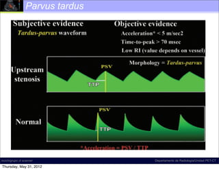 Parvus tardus




incich/grupo ct scanner   Diagram illustrates upstream stenosis
                                                     Departamento de Radiología/Unidad PET-CT

Thursday, May 31, 2012
 