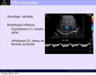 VSH normales


     • Abordaje: variable

     • Morfología trifásica:
       • Suprabasal (1): sístole
         atrial

             • Infrabasal (2): fases de
               llenado auricular




incich/grupo ct scanner                   Departamento de Radiología/Unidad PET-CT

Thursday, May 31, 2012
 