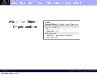 Venas hepáticas: anomalías espectro


  176    January-February 2011                                                        radiographics.rsna.org


      • Alta pulsatilidad:
    corresponds to maximal retrograde hepatic ve-
    nous ﬂow. In physiologic states, the peak of the
                                                           Table 6
                                                           Causes of Pulsatile Hepatic Venous Waveform
    a wave is above the baseline, and the a wave is
             • Origen: cardiaco
    wider and taller than the v wave (the other po-        Tricuspid regurgitation
                                                             Decreased or reversed S wave
    tentially retrograde wave). Even in pathologic
    states, the a wave remains wider than the v wave,        Tall a and v waves
    which represents the best way to initially orient      Right-sided CHF
    oneself on the waveform. The only time this rule         Maintained S wave/D wave relationship
    breaks down is in cases of severe tricuspid regur-       Tall a and v waves
    gitation, when the S wave becomes retrograde
    and merges with the a and v waves to form one
    large retrograde a-S-v complex.
       The S wave is the next wave encountered           grade diastolic velocity is maximal. The subse-
    on the waveform. Its initial downward-sloping        quent rising portion results from increasing right
    portion is generated by decreasing right atrial      atrial pressure generated by the increasing right
    pressure, as a result of the “sucking” effect cre-   ventricular blood volume.
    ated by the downward motion of the atrioven-            It is almost unheard of to describe ﬂow in the
    tricular septum as it descends toward the cardiac    hepatic veins as hepatofugal, since the term is
    apex during early to midsystole. Note that the       reserved for describing the state of pathologic
    tricuspid valve remains closed. If it were open      ﬂow in the portal veins. However, it is important
    (tricuspid regurgitation), the result would be       to remember that physiologic ﬂow in the hepatic
    pathologic retrograde ﬂow. The S wave corre-         veins is hepatofugal (ie, away from the liver and
    sponds to antegrade hepatic venous ﬂow and is        toward the heart). In summary, the hepatic ve-
    the largest downward-pointing wave in the cycle.     nous waveform is normally phasic and predomi-
    The lowest point occurs in midsystole and is the     nantly antegrade.
incich/grupo ct scanner                                                                      Departamento de Radiología/Unidad PET-CT
    point at which negative pressure is minimally op-       Abnormal (pathologic) hepatic venous ﬂow
 Thursday, May 31, 2012velocity is maximal. After
    posed and antegrade                                  may manifest in one of several basic ways.
 