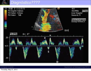 Diagnóstico????




incich/grupo ct scanner            Departamento de Radiología/Unidad PET-CT

Thursday, May 31, 2012
 