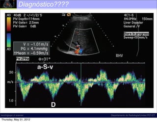 Diagnóstico????



                           Insuficiencia tricuspídea
                          moderada (S < D, >>> a/v)




incich/grupo ct scanner                          Departamento de Radiología/Unidad PET-CT

Thursday, May 31, 2012
 