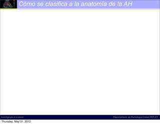 Cómo se clasifica a la anatomía de la AH




incich/grupo ct scanner                           Departamento de Radiología/Unidad PET-CT

Thursday, May 31, 2012
 