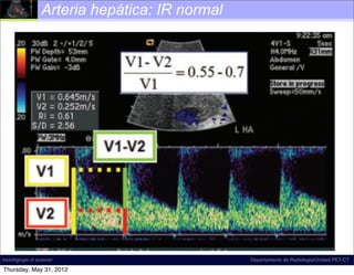 Arteria hepática: IR normal




incich/grupo ct scanner                        Departamento de Radiología/Unidad PET-CT

Thursday, May 31, 2012
 