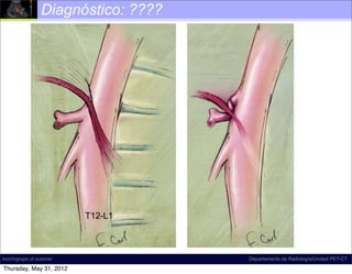 Diagnóstico: ????




                          T12-L1



incich/grupo ct scanner              Departamento de Radiología/Unidad PET-CT

Thursday, May 31, 2012
 