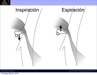 Inspiración   Espiración




incich/grupo ct scanner                    Departamento de Radiología/Unidad PET-CT

Thursday, May 31, 2012
 