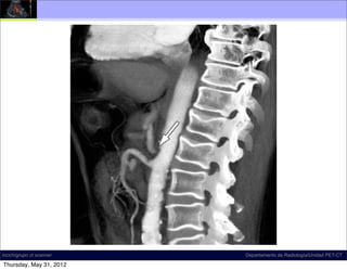 incich/grupo ct scanner   Departamento de Radiología/Unidad PET-CT

Thursday, May 31, 2012
 