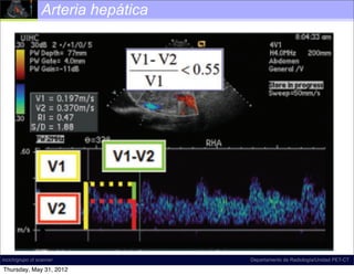 Arteria hepática




incich/grupo ct scanner             Departamento de Radiología/Unidad PET-CT

Thursday, May 31, 2012
 