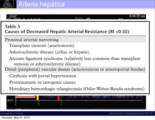 Arteria hepática
        Advanced patient age




    Proximal arterial narrowing
      Transplant stenosis (anastomosis)
      Atherosclerotic disease (celiac or hepatic)
      Arcuate ligament syndrome (relatively less common than transplant
        stenosis or atherosclerotic disease)
    Distal (peripheral) vascular shunts (arteriovenous or arterioportal ﬁstulas)
      Cirrhosis with portal hypertension
      Posttraumatic or iatrogenic causes
      Hereditary hemorrhagic telangiectasia (Osler-Weber-Rendu syndrome)




incich/grupo ct scanner                                     Departamento de Radiología/Unidad PET-CT

Thursday, May 31, 2012
 