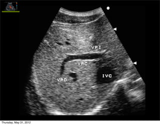 Thursday, May 31, 2012
 