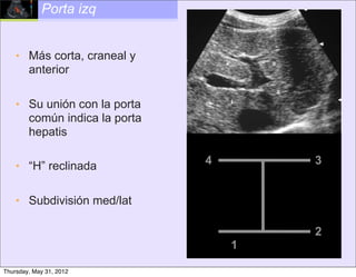 Porta izq


    • Más corta, craneal y
      anterior

    • Su unión con la porta
      común indica la porta
      hepatis

    • “H” reclinada           4       3


    • Subdivisión med/lat

                                      2
                                  1

Thursday, May 31, 2012
 