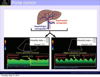 Porta común




incich/grupo ct scanner        Departamento de Radiología/Unidad PET-CT

Thursday, May 31, 2012
 