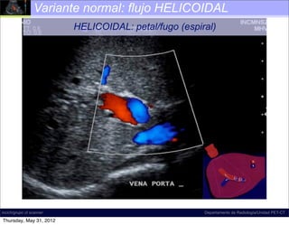 Variante normal: flujo HELICOIDAL
                          HELICOIDAL: petal/fugo (espiral)




incich/grupo ct scanner                                Departamento de Radiología/Unidad PET-CT

Thursday, May 31, 2012
 