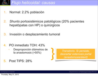 Flujo helicoidal: causas

     1. Normal: 2.2% población

     2. Shunts portosistémicos patológicos (20% pacientes
        hepatópatas con HP) o quirúrgicos

     3. Invasión o desplazamiento tumoral




                                                  }
     4. PO inmediato TOH: 43%
             •       Desproporción diámetros de
                                                       Transitorio. Si persiste,
                     la anastomosis (>50%)
                                                      descartar estenosis portal
                                                         (anastomosis/stent)
     5. Post TIPS: 28%


incich/grupo ct scanner                                      Departamento de Radiología/Unidad PET-CT

Thursday, May 31, 2012
 
