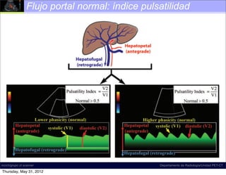 Flujo portal normal: índice pulsatilidad




incich/grupo ct scanner                          Departamento de Radiología/Unidad PET-CT

Thursday, May 31, 2012
 