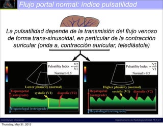 Flujo portal normal: índice pulsatilidad


     La pulsatilidad depende de la transmisión del flujo venoso
     de forma trans-sinusoidal, en particular de la contracción
       auricular (onda a, contracción auricular, telediástole)




incich/grupo ct scanner                          Departamento de Radiología/Unidad PET-CT

Thursday, May 31, 2012
 