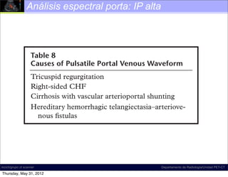 blue on the color Doppler US image and is displayed
                                                                                              the
           below the baseline on the porta: waveform. Hepa-
            Análisis espectral spectral IP alta
           tofugal ﬂow is due to severe portal hypertension from                              the
           any cause.                                                                         sati
                                                                                              scri
                                                                                              pre
               Table 8
                                                                                              por
               Causes of Pulsatile Portal Venous Waveform                                     side
                                                                                              tran
               Tricuspid regurgitation
                                                                                              arte
               Right-sided CHF
                                                                                              ver
               Cirrhosis with vascular arterioportal shunting
                                                                                              her
               Hereditary hemorrhagic telangiectasia–arteriove-                               this
                 nous ﬁstulas                                                                    I
                                                                                              am
                                                                                              red
                                                                                              usu
                     Findings That Are Diagnostic for Portal Hy-                              tion
                     pertension
incich/grupo ct scanner
                                                                                              by
                                                          Departamento de Radiología/Unidad PET-CT

Thursday, May 31, 2012
 