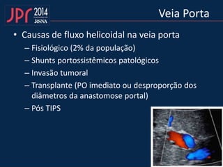 Veia Porta
• Causas de fluxo helicoidal na veia porta
– Fisiológico (2% da população)
– Shunts portossistêmicos patológicos
– Invasão tumoral
– Transplante (PO imediato ou desproporção dos
diâmetros da anastomose portal)
– Pós TIPS
 