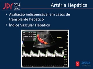 Artéria Hepática
• Avaliação indispensável em casos de
transplante hepático
• Índice Vascular Hepático
 