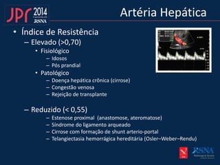 Artéria Hepática
• Índice de Resistência
– Elevado (>0,70)
• Fisiológico
– Idosos
– Pós prandial
• Patológico
– Doença hepática crônica (cirrose)
– Congestão venosa
– Rejeição de transplante
– Reduzido (< 0,55)
– Estenose proximal (anastomose, ateromatose)
– Síndrome do ligamento arqueado
– Cirrose com formação de shunt arterio-portal
– Telangiectasia hemorrágica hereditária (Osler–Weber–Rendu)
 