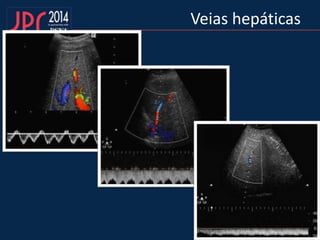 Veias hepáticas
 