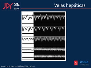 Veias hepáticas
Kim MY et al. Liver Int. 2007 Oct;27(8):1103-10
 