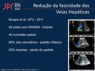 Redução da fasicidade das
Veias Hepáticas
 Borges et al. UFU - 2011
 40 pctes com DHGNA - biópsia
 40 controles sadios
 95% dos voluntários - padrão trifásico
 55% doentes - perda do padrão
Borges V et al. Radiol Bras. 2011 Jan/Fev;44(1):1–6
 