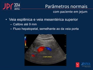 Parâmetros normais
com paciente em jejum
• Veia esplênica e veia mesentérica superior
– Calibre até 9 mm
– Fluxo hepatopetal, semelhante ao da veia porta
 